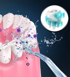 Fil Dentaire électrique - ROSE - 3 Modes - 360 Degrés - Portable - Protection Powerful - Prise DC Sans Fil -Dentaires Appareils Magasin 1089x1200 1