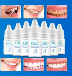 Blanchiment Des Dents B-care - Dents Plus Blanches - Bandes De Blanchiment Des Dents - Résultat Professionnel - Détartrant - Sans Peroxyde - Ensemble De Blanchiment Des Dents - Blanchiment Des Dents -Dentaires Appareils Magasin 1138x1200 1