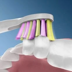 Brosse à Dents électrique Fairywill FW507 - Technologie Sonique - 3 Modes Personnalisés - Avec 3 Têtes De Brosse - Rose -Dentaires Appareils Magasin 1197x1200