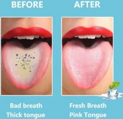 Arctic Fox® Gratte-langue En Acier Inoxydable De Haute Qualité Pour Soins Bucco-dentaires - 4 Pièces - Nettoyeur De Langue, Brosse à Langue Et Grattoir à Langue Et Boîte De Rangement En Acier Inoxydable - Durable Et Réutilisable -Dentaires Appareils Magasin 1200x1160 15