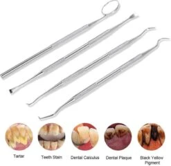 Ensemble Complet De Dentiste - Crochet Tartare De 4 Pièces - Crochet Pour Dentiste - Miroir Buccal - Outils Pour Dentiste - Soins Bucco-dentaires - Acier Inoxydable -Dentaires Appareils Magasin 1200x1166 2