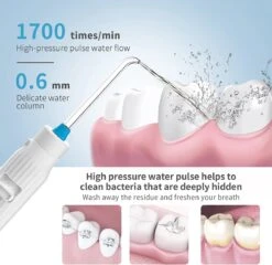 YOUNGDO Irrigateur Buccal, Nettoyeur De Dents Avec Désinfection UV, Irrigateur Buccal Fixe Avec Réservoir D'eau De 800 Ml Et 7 Buses, Ailette D'eau, Idéal Pour La Famille -Dentaires Appareils Magasin 1200x1166 3