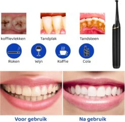 ExCorn Electric Tandsteen Verwijderaar - Élimination électrique De La Plaque Dentaire - Kit Dentaire Inclus - Polissage Du Tartre -Dentaires Appareils Magasin 1200x1173 2