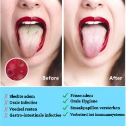 Grattoir à Langue En Acier Inoxydable Pour Soins Bucco-dentaires - Ensemble De Grattoir à Langue - Nettoyeur De Langue - Brosse à Langue - Hygiène Buccale - Grattoir à Langue - Durable Et Réutilisable -Dentaires Appareils Magasin 1200x1194 3