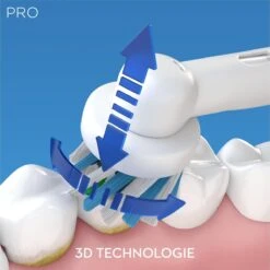 Oral B Oral-B PRO 2 2000S Sensi Ultrathin Adulte Brosse à Dents Rotative Oscillante Noir, Blanc -Dentaires Appareils Magasin 1200x1200 20