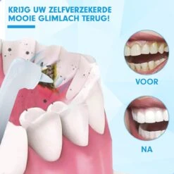 Polisseuse à Dents électrique DEN-T® PRO P350 - Wit - 5 Positions - 5 Accessoires - Polisseuse - Set De Polissage - Utilisable Avec Pâte à Polir & Tandpasta -- -Dentaires Appareils Magasin 1200x1200 365