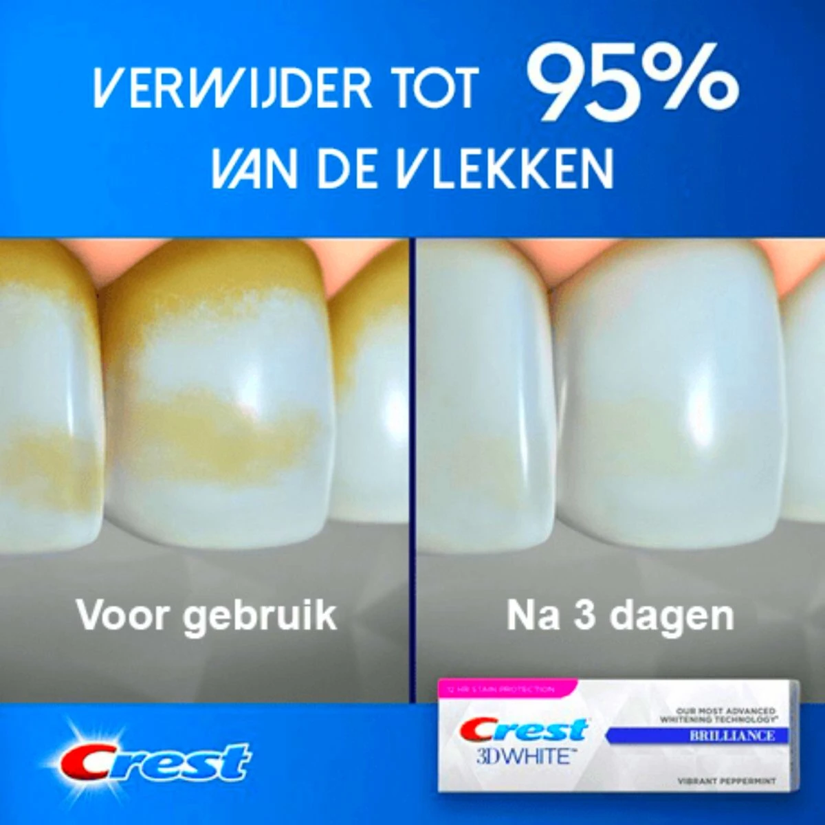 Crest® Crest 3D White Brilliance Accélérateur De Blanchiment Des Dents Dentifrice Blanchissant - Dentifrice Pour Blanchiment Et Traitement Intensif De Blanchiment Et De L'Émail - Dentifrice Blanchissant - 3 X 75ml - Pack De Valeur 2 Crest® Crest 3D White Brilliance Accélérateur De Blanchiment Des Dents Dentifrice Blanchissant - Dentifrice Pour Blanchiment Et Traitement Intensif De Blanchiment Et De L'Émail - Dentifrice Blanchissant - 3 X 75ml - Pack De Valeur – Image 2