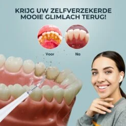 Détartrant électrique - Brosse à Dents - Embout Brosse à Dents - 5 Embouts - Set Dentiste - Rechargeable - 5 Positions - Miroir Dentiste -Dentaires Appareils Magasin 1200x1200 538