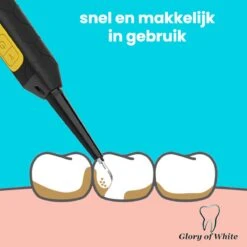Glory Of White Tandsteen Verwijderaar Professionnel - Élimination De La Plaque électrique - Polissage Des Dents -Dentaires Appareils Magasin 1200x1200 543