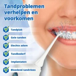 Hydropulseur Optismile - Irrigateur Oral électrique - Sans Fil Et Rechargeable - Comprend Deux Accessoires -Dentaires Appareils Magasin 1200x1200 695