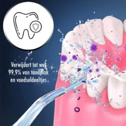 Hydropulseur - Appareil De Soie Sans Fil - Irrigateur Oral Électrique - 3 Positions - 4 Attachements - USB - Set Complet -Dentaires Appareils Magasin 1200x1200 719