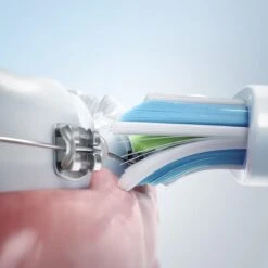 Philips Sonicare ProtectiveClean 4300 HX6809/35 Brosse à Dents électrique Adulte Brosse à Dents à Ultrasons Bleu, Blanc 39 Philips Sonicare ProtectiveClean 4300 HX6809/35 Brosse à Dents électrique Adulte Brosse à Dents à Ultrasons Bleu, Blanc -Dentaires Appareils Magasin 1200x1200 99