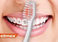 Brosse à Dents Souple ELMEX ORTHO Spécialement Pour Les Porteurs D'appareils Orthopédiques | Paquet De 2 -Dentaires Appareils Magasin 1200x859