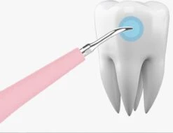 VITADO Tandsteen Verwijderaar Electrique BLEU - Soins Bucco-dentaires - Nettoyage Des Dents - Élimination Du Tartre électrique - Nettoyant Pour Dents - Décapant De Plaque Dentaire ROSE -Dentaires Appareils Magasin 1200x925 3